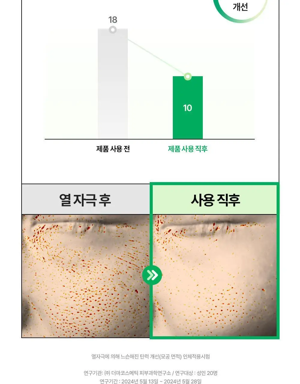[5월 올영픽/포켓몬 에디션] 듀이트리 AC 딥 열감 진정 마스크 10매 기획 (+1매+포켓몬 스티커) 상세페이지 29